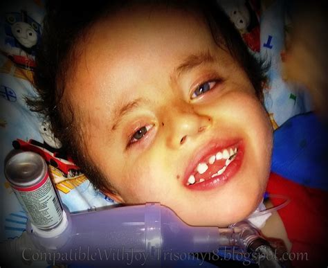 Compatible With Joy-Trisomy18: Finally...