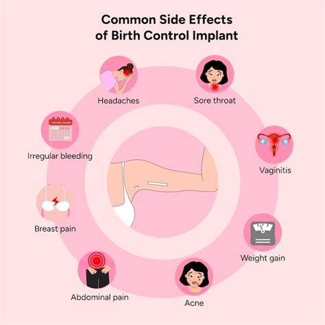 Premium Vector | Common side effects from birth control implant in vector