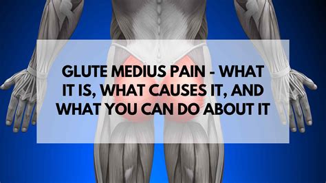 Gluteus Medius Pain Archives - Acupuncture , Dry Needling, Prolotherapy ...