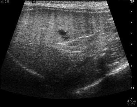 Imaging of the liver and pancreas - Vet Focus