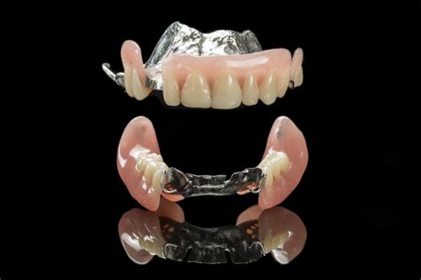 Metal Dentures: What are They and What Do You Need to Know About Them - Harcourt Health