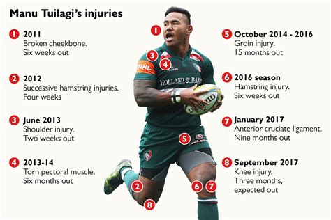 Manu Tuilagi’s tale of injury woe: how long has he been out for? | Sport | The Times