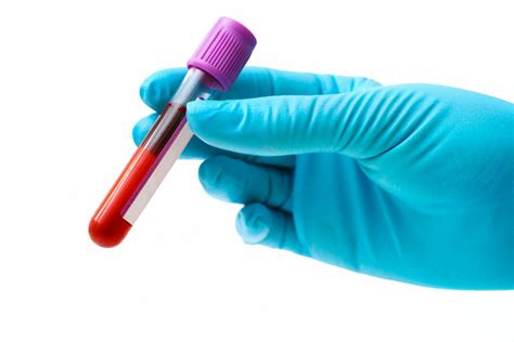 Low MCHC in blood tests: Symptoms and causes