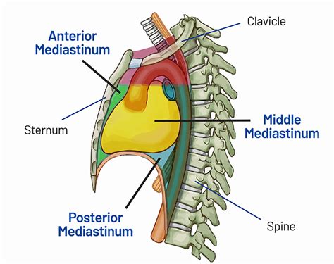 Mediastinal Tumor (Mass): Symptoms, Diagnosis and Stages | Saint John’s Cancer Institute