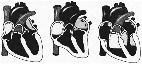 Diagrammatic representations showing the phases of the cardiac cycle ...