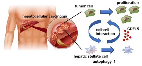 Liver cancer cells manipulate stromal cells i | EurekAlert!