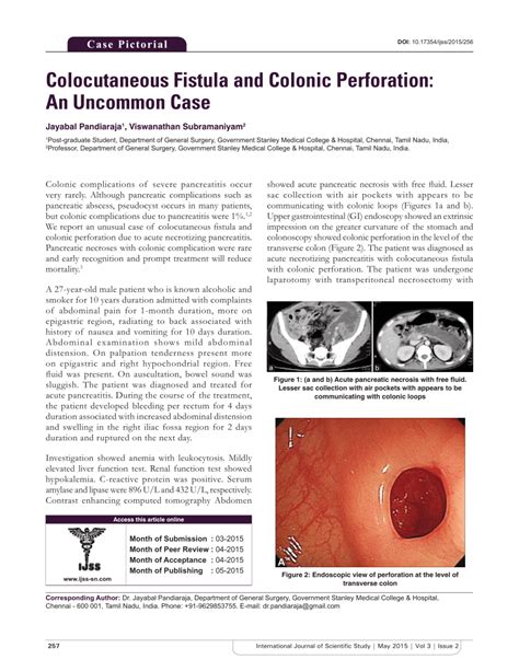 (PDF) Colocutaneous Fistula and Colonic Perforation: An Uncommon Case