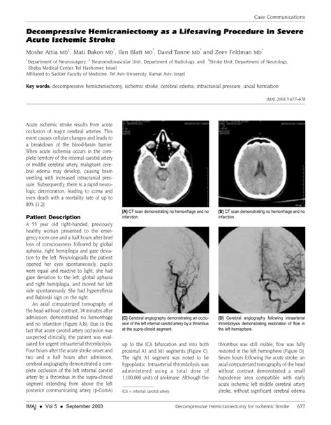 (PDF) Decompressive hemicraniectomy as a lifesaving procedure in severe ...