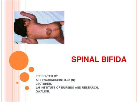 Spina Bifida Pathophysiology