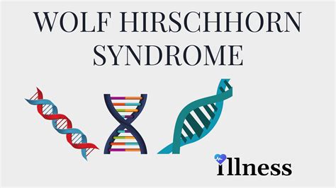 Wolf Hirschhorn Syndrome : Overview, Causes, Symptoms, Treatment ...