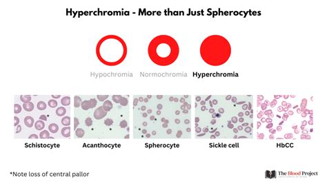 Red Cell Staining (Color) • The Blood Project