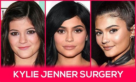 Kylie Jenner Surgery: Procedures & Rumors With Pictures - Vera Clinic