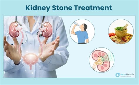 Kidney Stone - Signs, Causes, Size, Diagnosis & Treatment