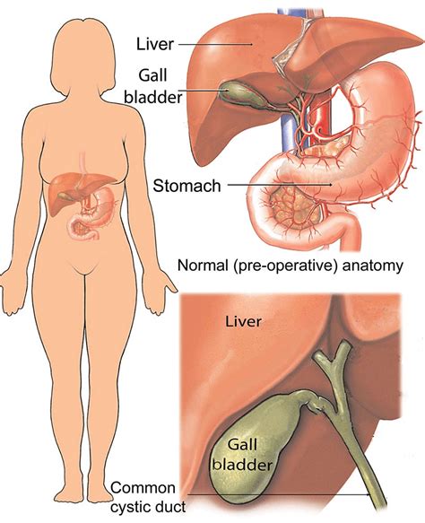 Gallbladder Pain Location Diagram - exatin.info