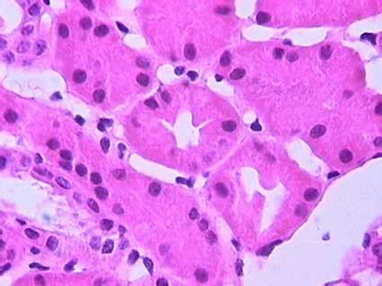 Histology Interstitium