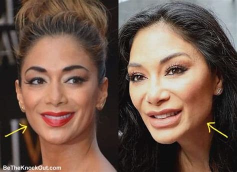 Nicole Scherzinger Plastic Surgery Comparison Photos