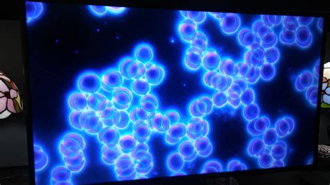 What to do about Thrombocyte Aggregation for a Healthy Heart