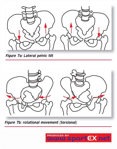 Lateral pelvic tilt and rotational movement (torsional) (1… | Flickr