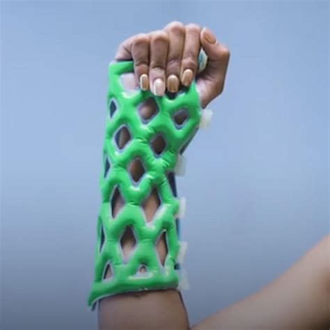 Waterproof arm cast is itch-free and hardens in under 10 minutes