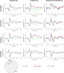 Frontiers | Influence of EEG References on N170 Component in Human Facial Recognition | Neuroscience