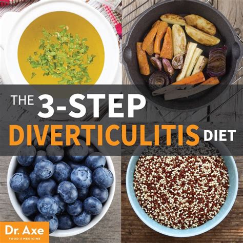 77 best images about Diverticulitis on Pinterest
