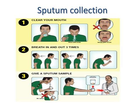 Fundamental Principle of Clinical Specimen Collection - Microbiology Notes