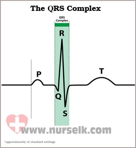 How to read an Electrocardiogram (ECG) - Part 5, The QRS Complex ...