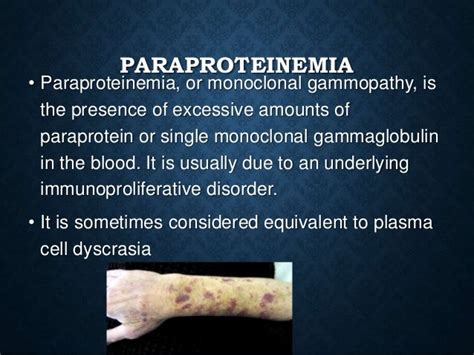 Immunoproliferative disorders[1]