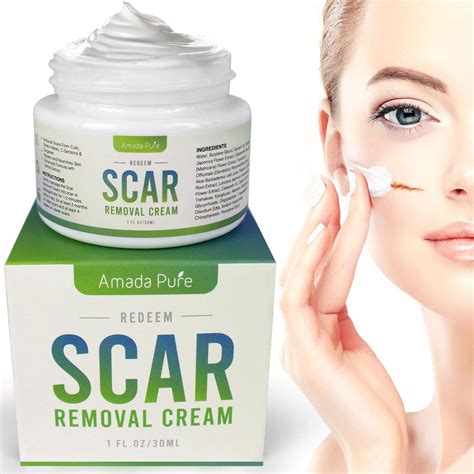 Best Scar Cream Buyers Guide 2020 - ReviewThis