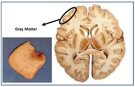 Optics | Free Full-Text | Spectral Optical Properties of Gray Matter in Human Male Brain Tissue ...