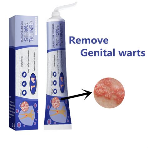 Ubat ketuat kelamin Kutil kelamin removal Genital warts removal cream Skin Tag Remover Warts ...