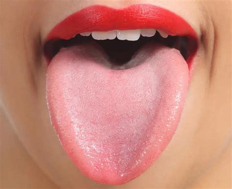 Spots on tongue: Causes and when to see a doctor