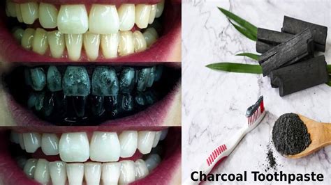 Charcoal Toothpaste - Whitening toothpaste, Does charcoal work?