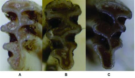 Morphotypes de la troisième molaire supérieure (M 3 gauche) chez A :... | Download Scientific ...