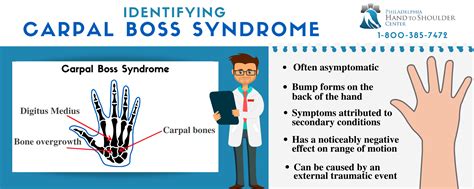 What Is Carpal Boss Syndrome and How Is It Treated?