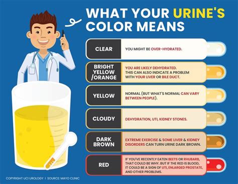 Can Vitamins Change The Color Of Your Urine - Hoff Tyrone