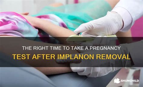 The Right Time To Take A Pregnancy Test After Implanon Removal | ShunChild