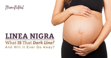 Linea Nigra Not Pregnant