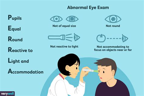 What PERRLA Means in Your Eye Exam