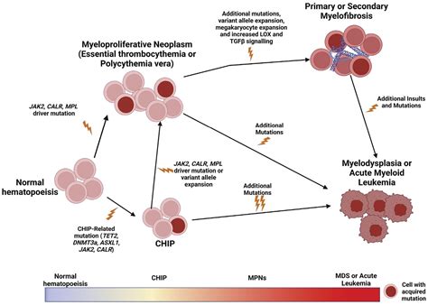 Cardiovascular Disease and Myeloproliferative Neoplasms | ASH Clinical ...