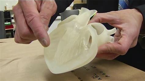 3D printing machines being used to make plastic model organs to save lives | abc7news.com