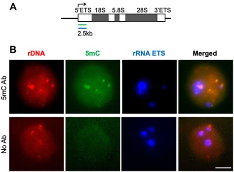 RNA FISH--EVA analysis of rDNA locus. (A) rDNA transcription unit and ...