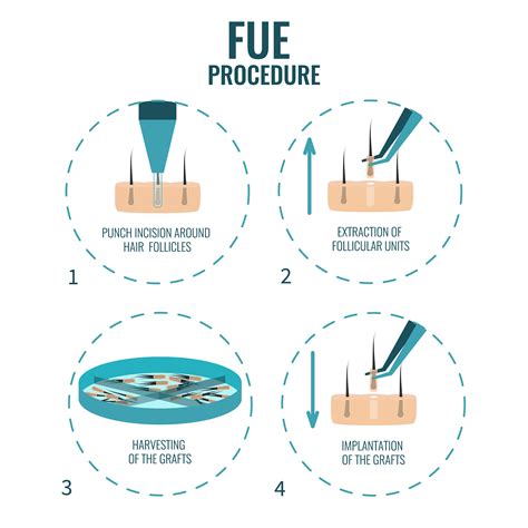 FUE Procedure – Steps | Expert Hair Transplant