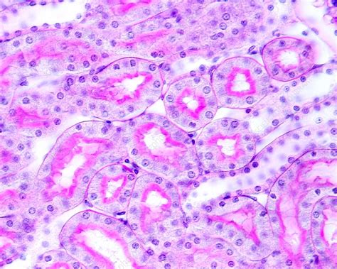 Distal Tubule Histology