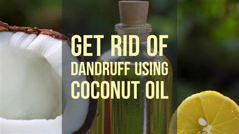 How to Get Rid of Dandruff using Coconut Oil