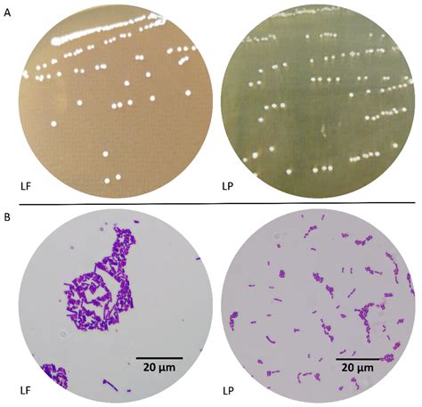 Morphology Of Lactobacillus | Hot Sex Picture