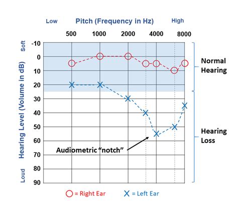 Noise Induced Audiogram