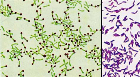 Habitat and Morphology of Corynebacterium diphtheriae