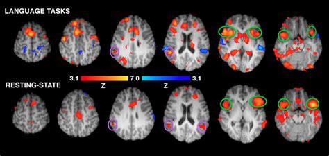 fMRI-brain-scans-neuromarketing