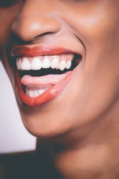 How To Get Rid Of Black Gums - Public Health